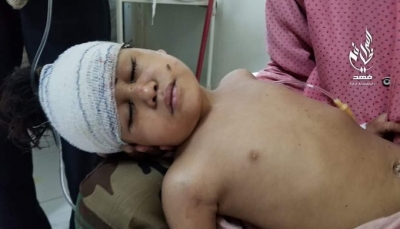 تعز: وفاة طفل متأثراً بإصابته جراء قصف حوثي