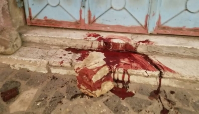 سقطت بالقرب من مستشفى.. مقتل وإصابة 4 مدنيين بقذيفة حوثية وسط مدينة تعز 