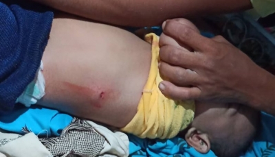 إصابة طفل برصاص مليشيات الحوثي جنوبي الحديدة