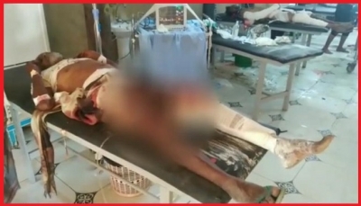 الحديدة: إصابة 3 مدنيين في قصف حوثي على حي منظر