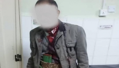 إصابة اثنين من أكاديميي جامعة صنعاء إثر عراك بينهما بالسلاح الأبيض 