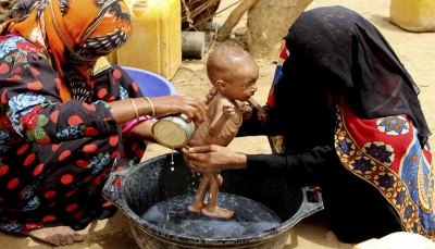 الأمم المتحدة: 16 مليون يمني يعانون من الجوع