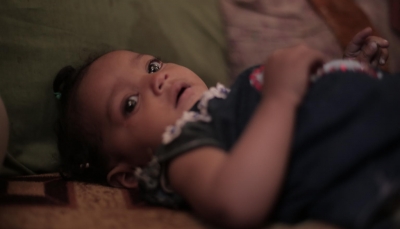اليونيسف: 22% نسبة ارتفاع حالات سوء التغذية باليمن خلال 2020