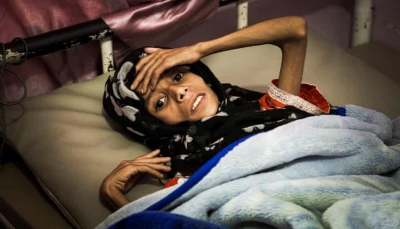 الغارديان: الحرب والمجاعة تهدد بالقضاء على الجيل القادم من اليمنيين (ترجمة خاصة)