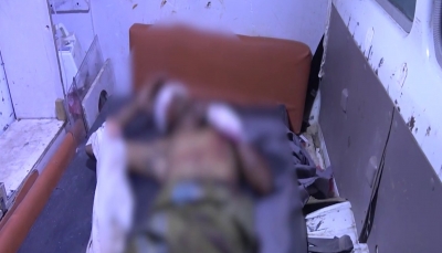 تعز: إصابة مدني في انفجار لغم أرضي زرعه الحوثيون بمديرية "ذو باب"