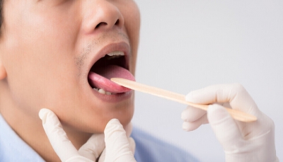  علامتان في الفم تدلان على ارتفاع مستويات السكر في الدم