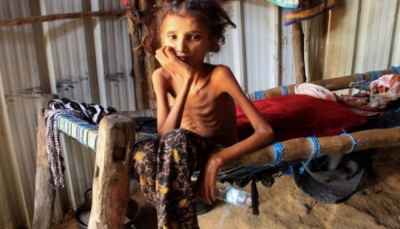 تقرير دولي: 80% من اليمنيين بحاجة إلى مساعدات وظهور بؤر أشبه بالمجاعة في ثلاث محافظات