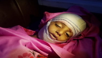 تعز.. مقتل طفل إثر قصف مدفعي شنته مليشيات الحوثي على قرى منطقة الضباب