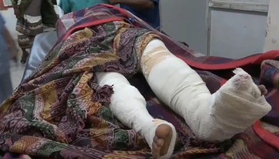 الحديدة.. إصابة امرأة إثر قصف حوثي على حي سكني بالتحيتا