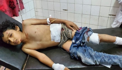 إصابة طفل في قصف لمليشيات الحوثي على الأحياء السكنية شرقي مدينة تعز