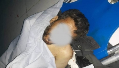 صنعاء.. مقتل مواطن برصاص مسلحين حوثيين في همدان