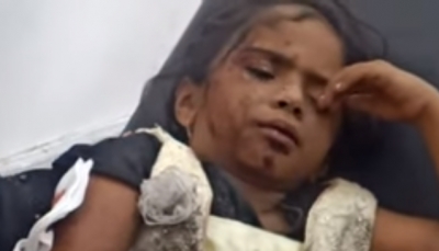 إصابة مسنة وطفلة بانفجار لغم حوثي بمديرية "جبل رأس" جنوب الحديدة
