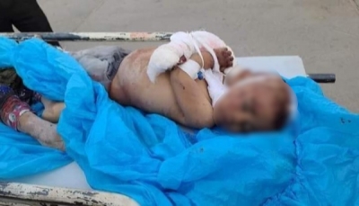 منظمة حقوقية: مقتل وإصابة أكثر من 14 ألف طفل يمني جراء الحرب