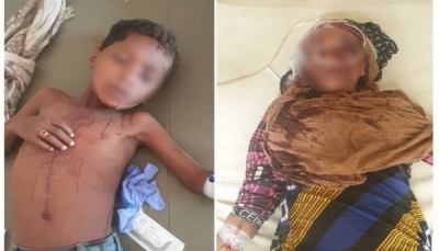 إصابة ثلاثة أطفال وامرأة بقصف لمليشيات الحوثي على مخيم للنازحين غرب تعز