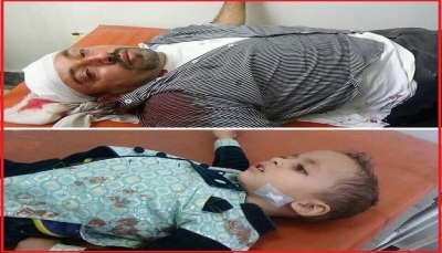 بينهم طفلين.. إصابة 4 مدنيين من أسرة واحدة بقصف حوثي شرقي تعز