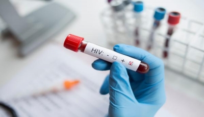 شفاء أول امرأة من فيروس "HIV" المسبب للإيدز.. كيف؟