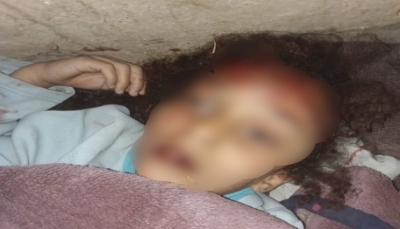 مقتل طفلة تحت التعذيب على يد والدها شمال محافظة إب