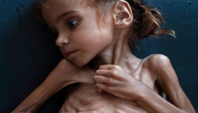 ماذا لو خصصت دول الخليج إيراد يوم من النفط والغاز لأطفال اليمن؟