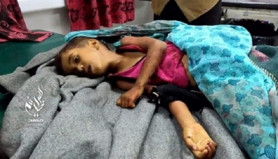 منظمات حقوقية تدين جرائم مليشيات الحوثي بحق المدنيين في تعز