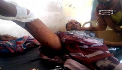 اليمن.. إصابة مواطن برصاص قناصة ميليشيا الحوثي شمال غربي الضالع
