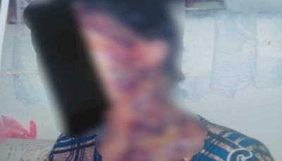 اليمن.. مسلح حوثي يقتل زوجته بطريقة مروعة في ذمار