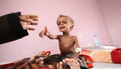 منظمة: امرأة وستة أطفال يموتون كل ساعتين في اليمن بسبب انهيار النظام الصحي