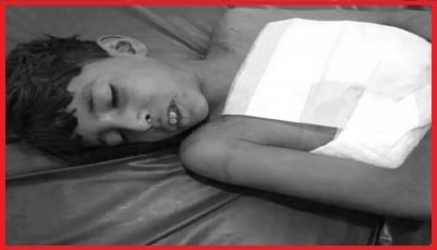 الطفولة في اليمن.. إرهاب حوثي متواصل بغطاء الهُدنة الأممية (تقرير خاص)