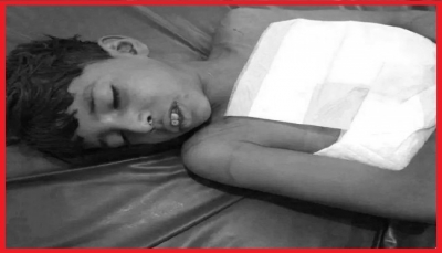 منظمة دولية: مقتل أو إصابة طفل كل يوم في اليمن خلال العام الجاري
