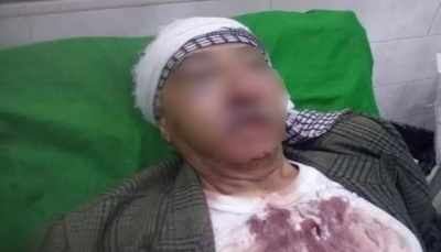 بعد اقتحام منزله.. مليشيا الحوثي تعتدي بالضرب على شيخ قبلي في عمران