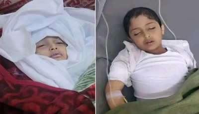 مسؤول حكومي سابق يطالب الصحة العالمية بالتحقيق في جريمة أطفال السرطان بصنعاء