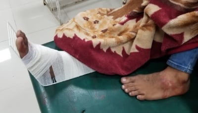 تعز.. 11 حالة استهداف وقصف للمدنيين من قبل مليشيات الحوثي خلال شهر أبريل الجاري