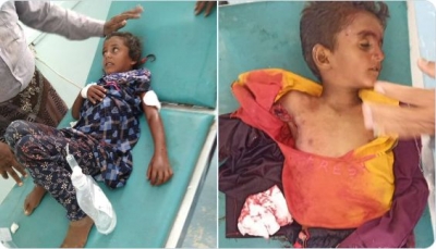 اليمن.. مقتل وإصابة طفلين شقيقين في قصف مدفعي لميليشيا الحوثي جنوبي الحديدة