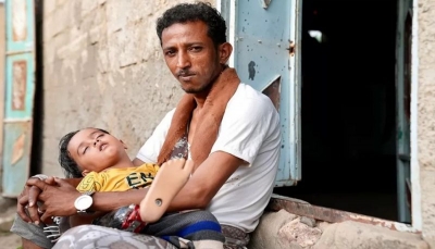 شهادات عن معاناة الأطفال الذين أصيبوا ويتضورون جوعا في حرب اليمن المنسية
