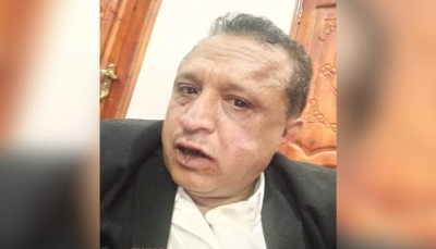 الحكومة ومنظمة سام تدينان اعتداء مليشيات الحوثي على الصحفي "مجلي الصمدي" في صنعاء