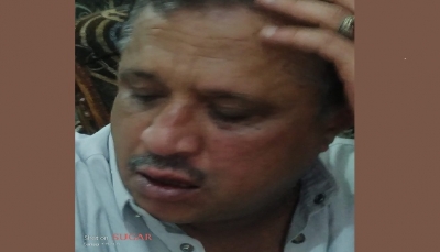 بعد مصادرة إذاعته.. تعرض الصحفي "مجلي الصمدي" للضرب من قبل عصابة أمام منزله بصنعاء