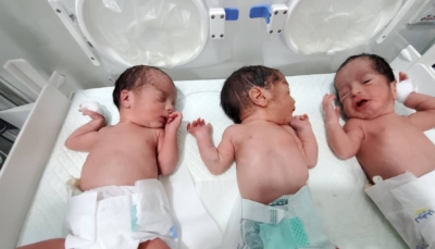 مأرب: حالة ولادة نادرة لتوأم ثلاثي بمستشفى حكومي