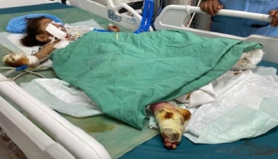 مرصد حقوقي: مقتل وإصابة 13 مدنياً جراء الألغام الحوثية منذ مطلع مايو الجاري