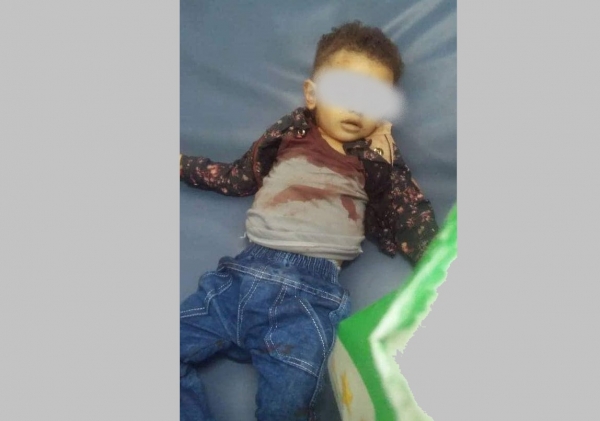 تعز: مقتل طفل ثاني وإصابة والديه برصاص قناص حوثي خلال 24 ساعة