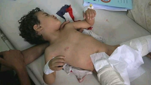 لحج: مقتل طفل برصاص قناصة الميليشيا الحوثية بالمقاطرة