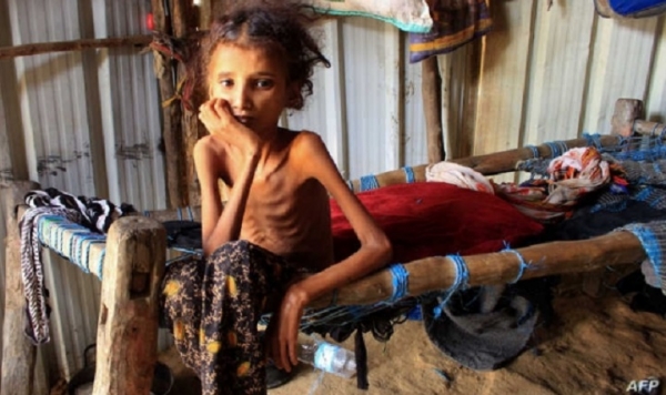 الأمم المتحدة: السلام هو الحل الوحيد لإنهاء الأزمة الإنسانية في اليمن