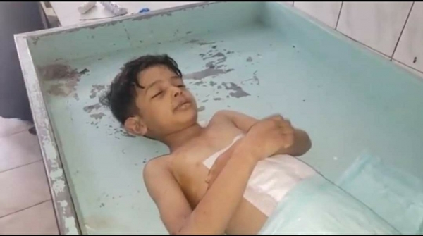 رابطة حقوقية: مقتل وإصابة أكثر من 14 الف طفل في اليمن غالبيتهم جراء القصف الحوثي