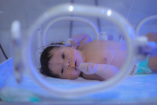 اليونيسف: رعاية حديثي الولادة من أكبر التحديات في جانب الرعاية الصحية باليمن