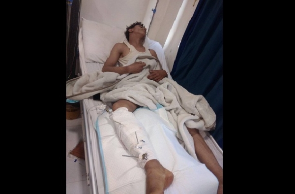 إب..قيادي حوثي يطلق النار على سائق دراجة نارية تلاسن مع نجله