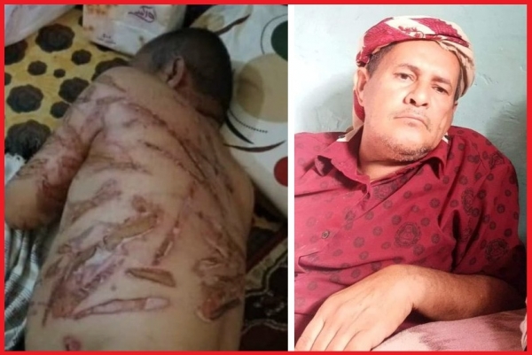 سام الحقوقية: احتجاز وتعذيب المُسن "محمد حسن عبده مهدي قائد" جريمة ضد الإنسانية تستوجب العقاب
