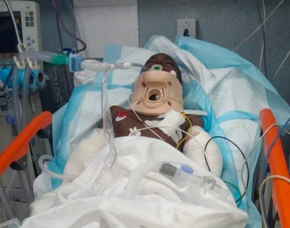 وفاة طفل متأثرا بجراحه بعد يومين من إصابته بانفجار لغم حوثي في حجة