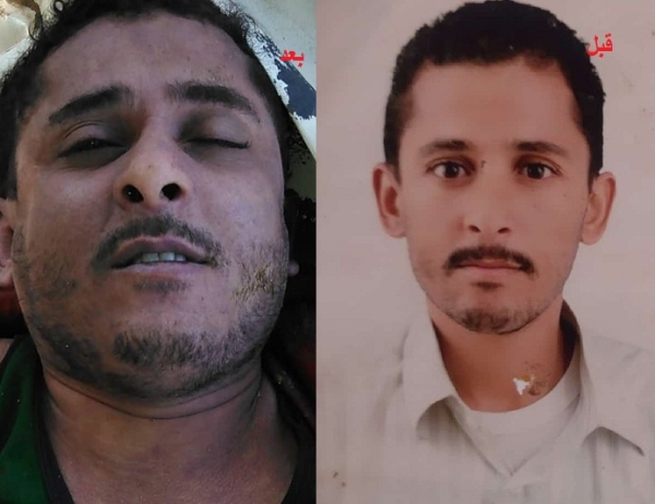 الثالث خلال 3 أشهر..وفاة مختطف في سجون مليشيا الحوثي بصنعاء