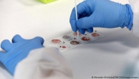 هل تؤثر فصيلة الدم على سرعة العدوى والاصابة بالمرض؟