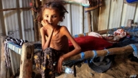 الغذاء العالمي: الأمن الغذائي في اليمن مستمر في التدهور